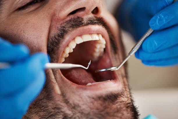 Dental Inlays and Onlays in Nixa, MO